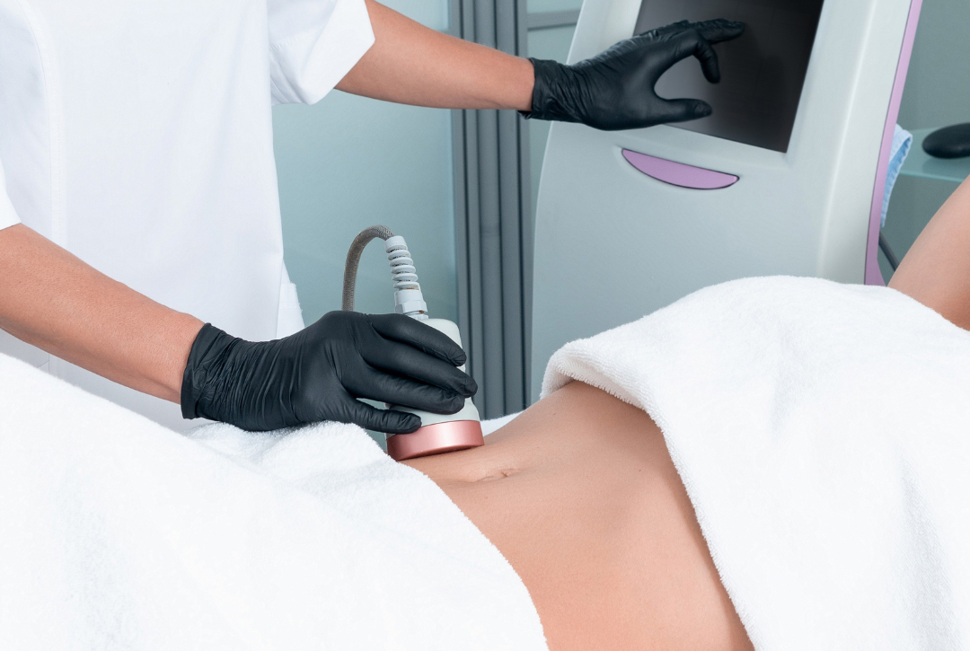 The Future of Body Contouring: What to Know About Ultrasonic Cavitation & Radio Frequency