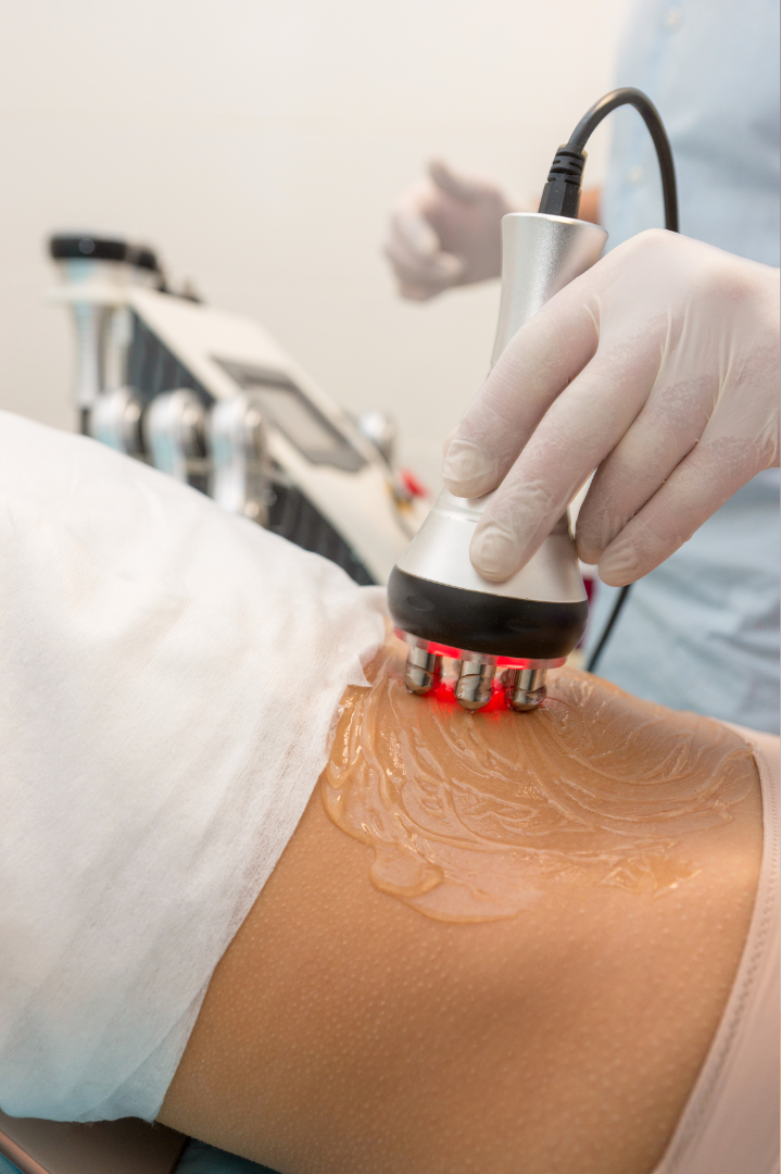 Austin Radio Frequency Training Course Skin Tightening