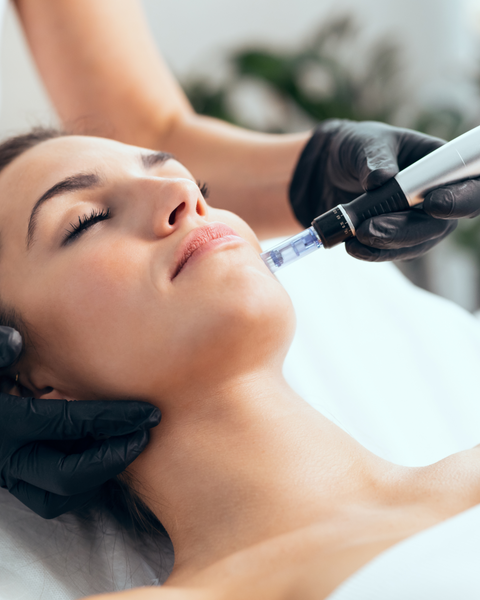 Intro to Microneedling